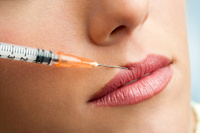 Удаление гиалуроновой кислоты из губ препаратом лидаза/лонгидаза